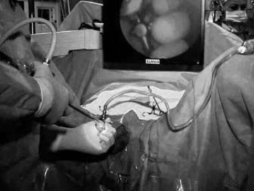 Yalova Devlet Hastanesinden Böbrek Hastalarına Müjde