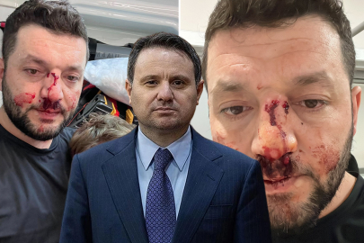 Esenköy’deki Saldırıya Adalet Bakanlığı El Koydu